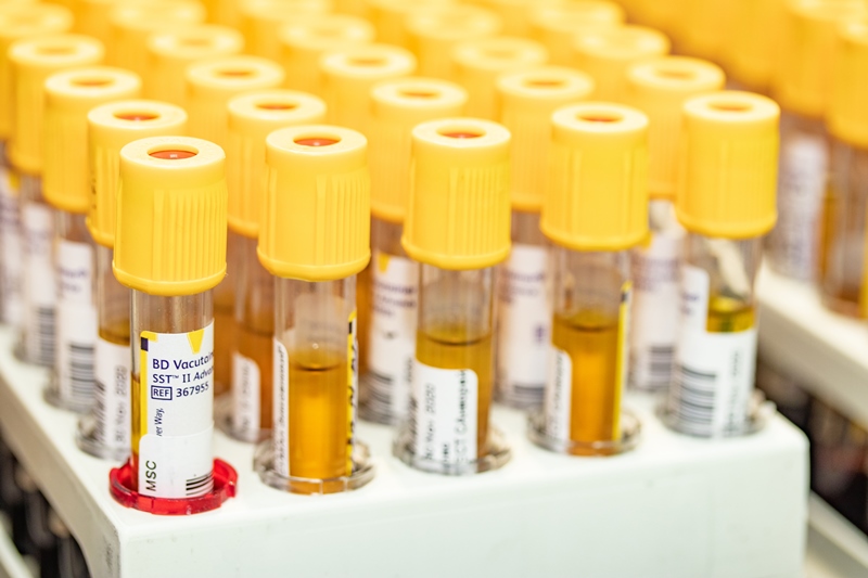 Как определить риск тяжелого течения COVID-19?