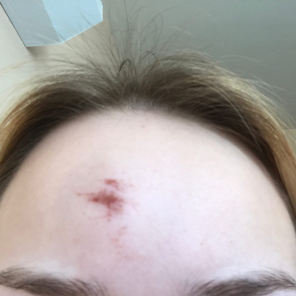 В Сызрани 17-летняя официантка обвинила в избиении владельца кафе