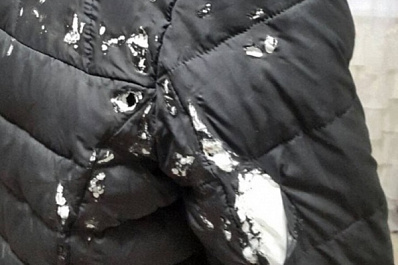 Облил антисептиком и поджёг: в Самаре школьник "проучил" одноклассницу