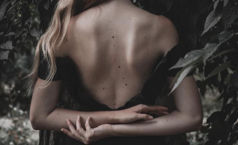 УФ-излучение или наследственность: дерматолог - о причинах появления родинок