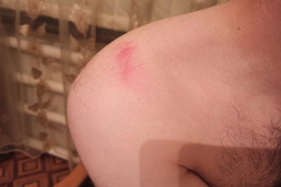 В Сызрани молодую пару покалечил опасный аттракцион