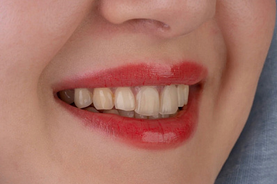 Детские стоматологи назвали пять правил здоровья полости рта