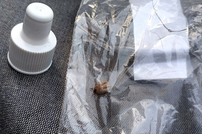 Врачи рассказали, что делать, если вас укусил клещ