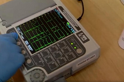 Как COVID-19 повлиял на лечение пациентов с сердечно-сосудистыми заболеваниями в Самарской области?