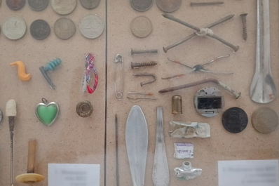 Стало известно, какие предметы достают врачи из ЖКТ самарцев