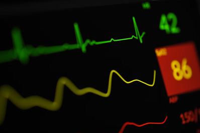 В Самарской области появятся три центра амбулаторной кардиологической помощи