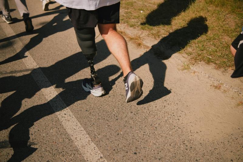 Эксперты расскажут, как облегчить адаптацию к жизни с протезом