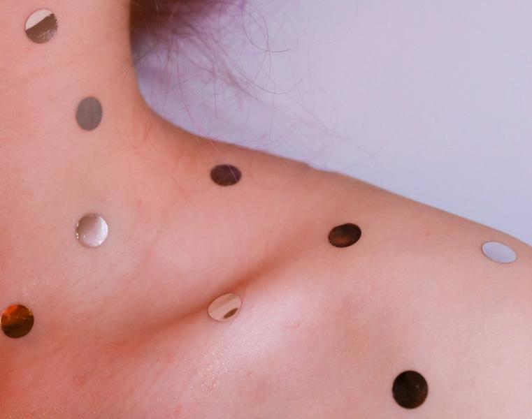 Ветряночные "вечеринки" - благо или вред? Мнение инфекционистов