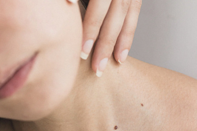 Врач: ранней весной обостряются хронические заболевания кожи