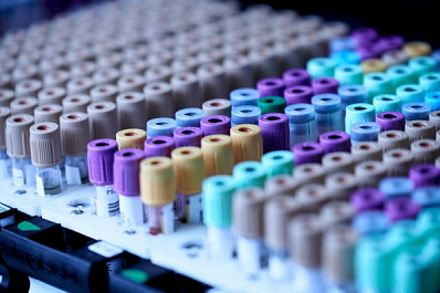 Вестники стенокардии: врач назвал основные симптомы густой крови у человека