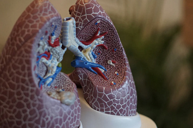 Торакальный хирург: рак лёгких часто развивается бессимптомно