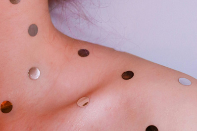 Ветряночные 