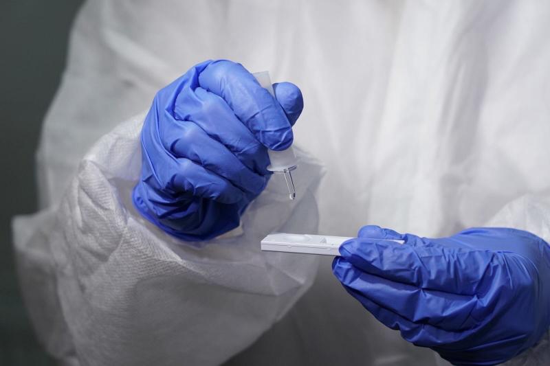 В Самарской области внедряют практику экспресс-тестирования на COVID-19