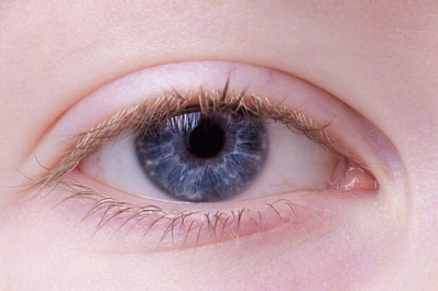 Жительница Самары нарастила ресницы и облысела