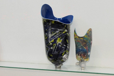 Заново учится ходить: боец СВО Дмитрий Киселев получил современный протез