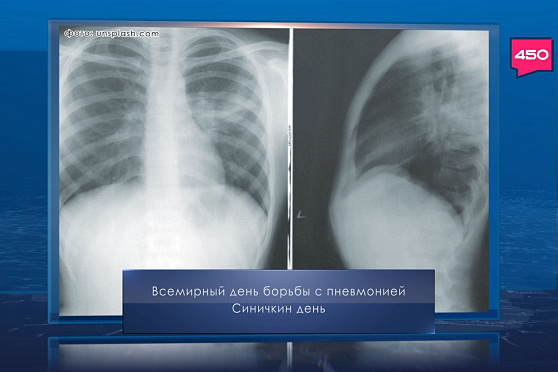 Всемирный день борьбы с пневмонией. Календарь Губернии от 12 ноября