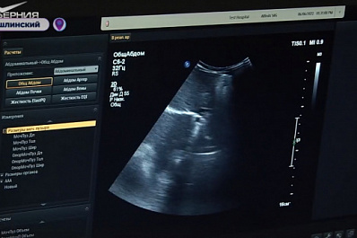 В Камышле на новых УЗИ-аппаратах с начала года обследовали 1400 пациентов