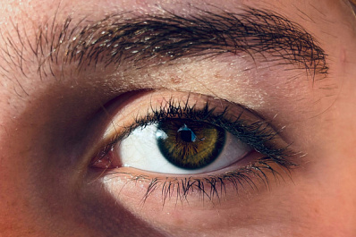 Самарский офтальмолог назвал причины появления аллергического конъюнктивита