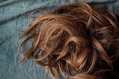 Больше полкило волос: врачи провели ребенку необычную операцию