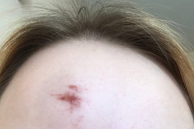 В Сызрани 17-летняя официантка обвинила в избиении владельца кафе