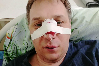 В Гранном избили начальника службы спасения