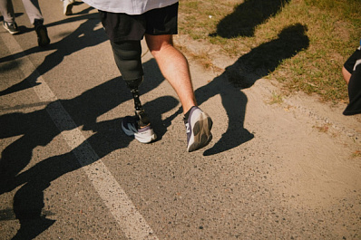 Эксперты расскажут, как облегчить адаптацию к жизни с протезом