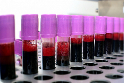 В Самаре в историческом парке пройдёт День донора