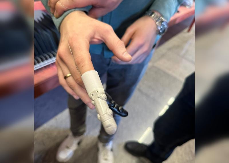 Первые в мире: резидент "Жигулевской долины" вывел на маркетплейс тяговые протезы пальцев