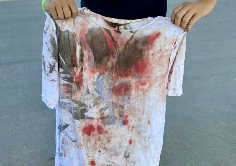 "Перелетел через руль самоката, был весь в крови": самарский школьник пострадал из-за лужи в экстрим-парке