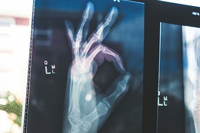 70 тысяч за сломанную руку: пенсионерка выиграла суд у коммунальщиков