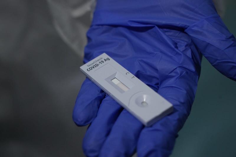 В Самарской области внедряют практику экспресс-тестирования на COVID-19