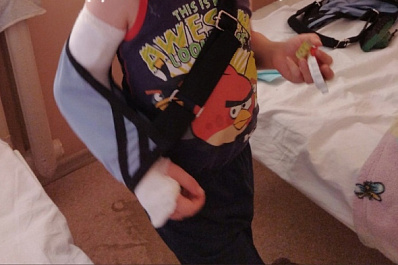 В Самаре прокуратура начала проверку в детсаду № 110 из-за травмирования ребенка на горке