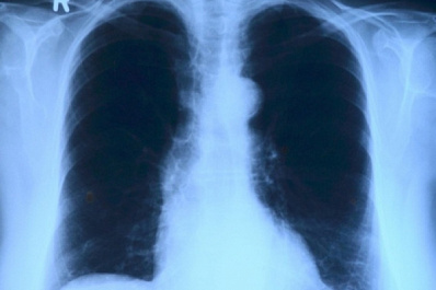 В инфекционных госпиталях установили комплексы цифровой рентгенографии