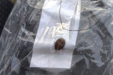 Без резких движений: как вести себя при укусе клеща