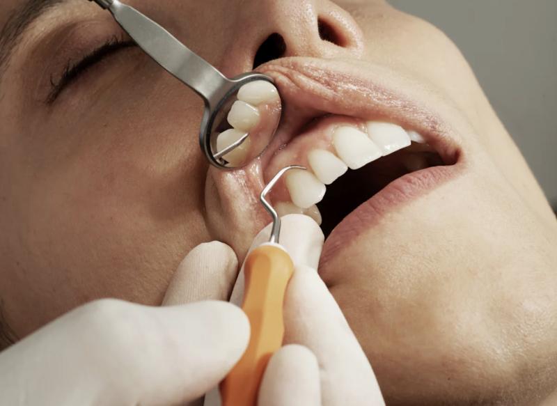 Самарский стоматолог: гигиена полости рта - залог здоровья всего организма