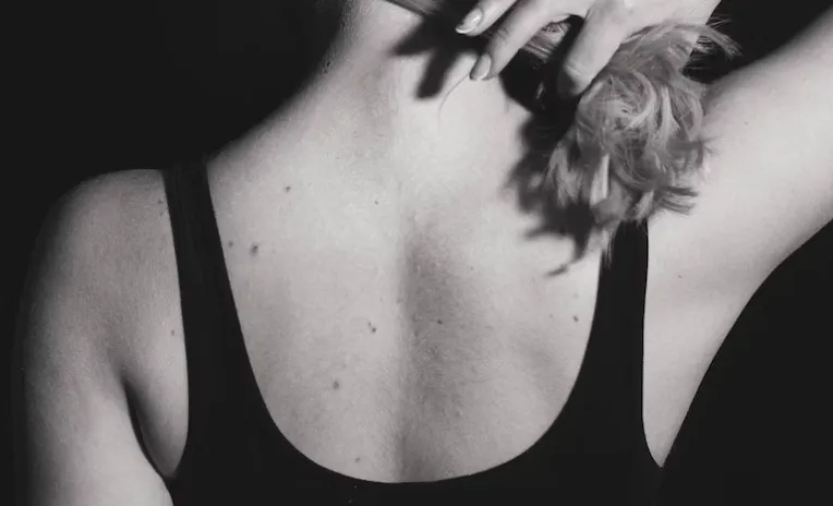 26 мая на самарской набережной можно будет бесплатно проверить родинки