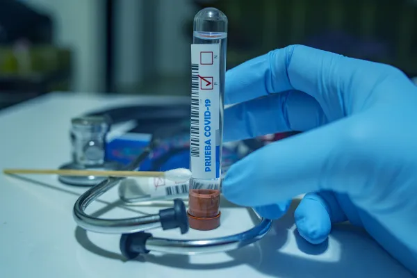 Коронавирус 22 января: заболело еще 286 жителей Самарской области